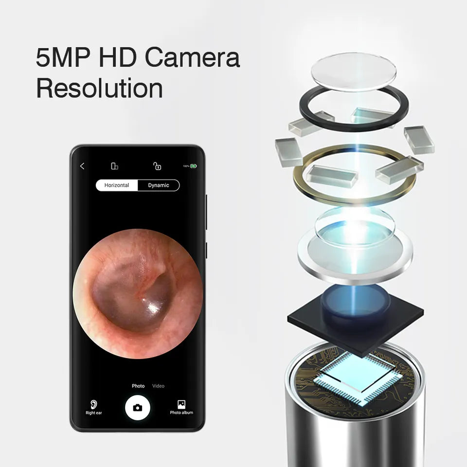 Smart Ear Cleaner- Professional HD Camera