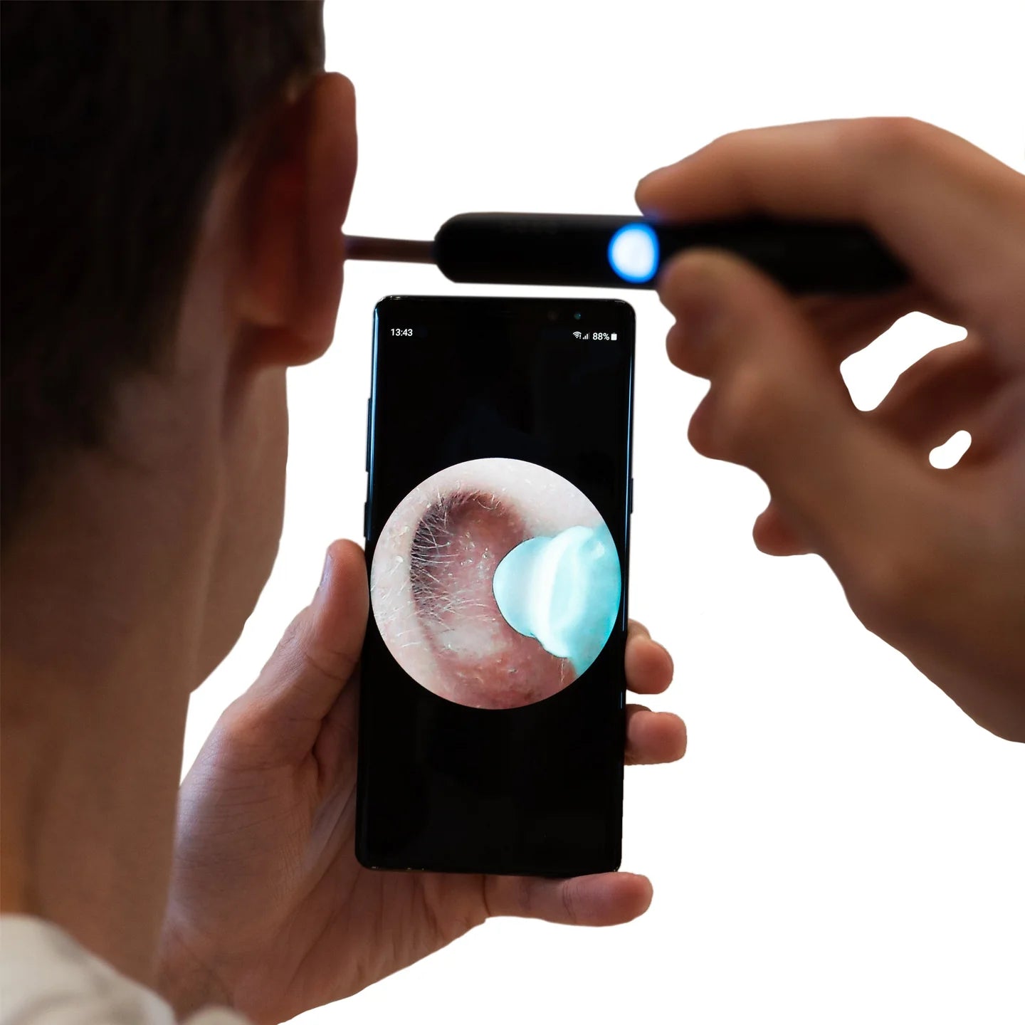 Smart Ear Cleaner- Professional HD Camera