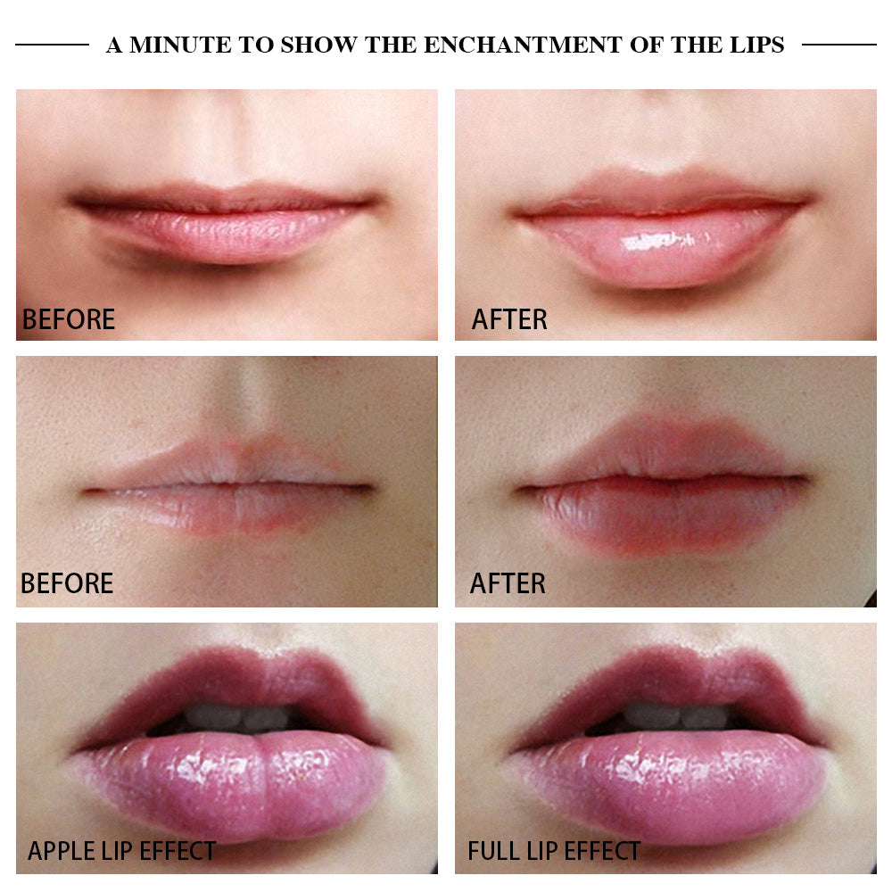 Lips Plumper